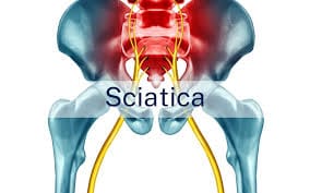 Stop Living in Pain: How Chiropractic Adjustments Can Relieve Sciatica and Headaches